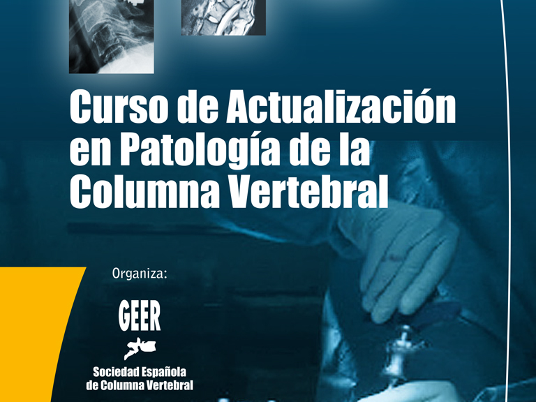 Curs Online GEER 2020 Patologia Vertebral