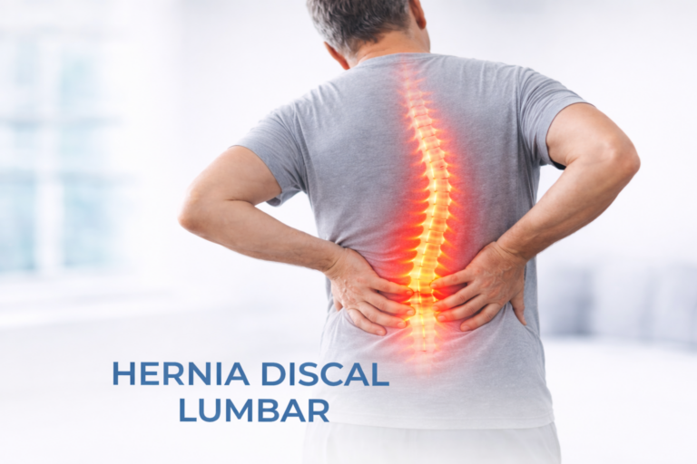 Hernia discal lumbar